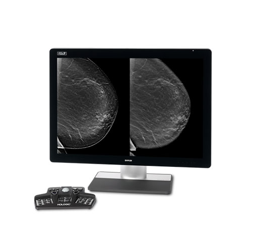 白い背景にホロジック Intelligent 2D Imaging テクノロジー