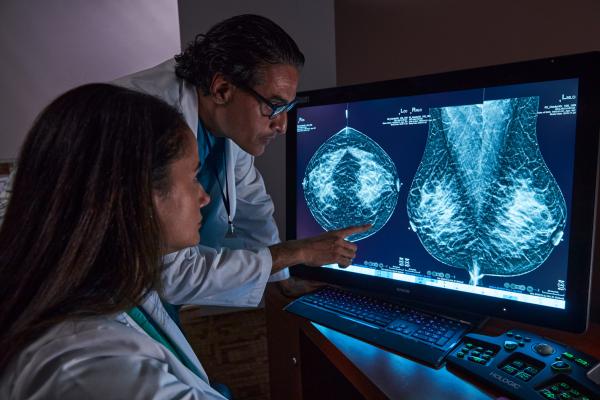 ToSyMa 試験の結果、乳がん検診の 3D の未来