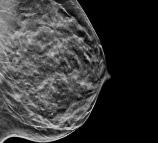 白い背景にホロジック C-View