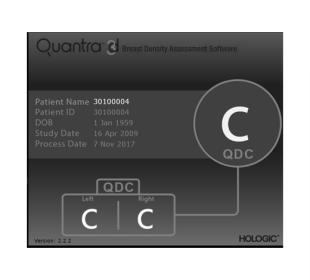 白い背景にホロジック Quantra 乳腺密度自動解析ソフトウェア