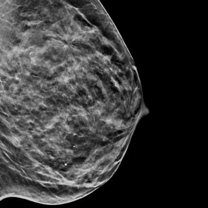 白い背景にホロジック C-View